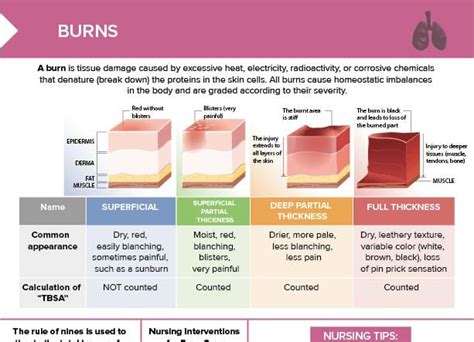 Classification Of Burn Depth Burns Nursing Nurse Brain Sheet | Hot Sex ...