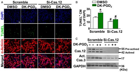 Crth2 Promotes Endoplasmic Reticulum Stress‐induced Cardiomyocyte