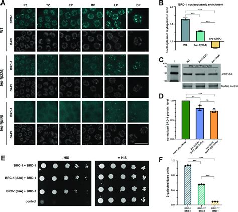 Nuclear Accumulation And BRC 1 BRD 1 Interaction Are Differentially