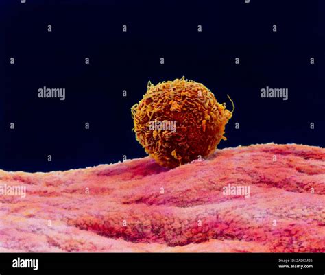 Fertilisation Coloured Scanning Electron Micro Graph SEM Of Sperm