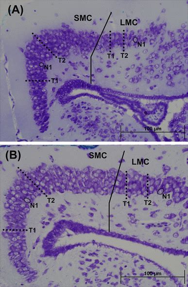 High Magnification Photomicrographs Of The Medial Cortex Cellular Layer