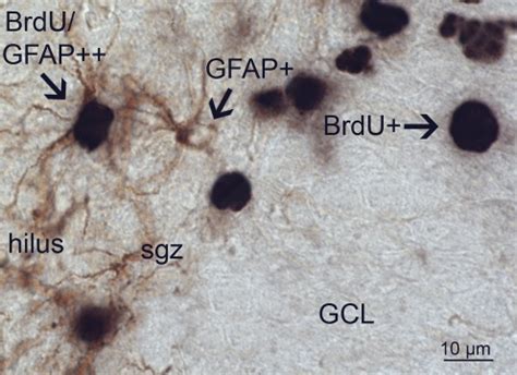 Immunohistochemical double labeling for GFAP and BrdU shows single ...