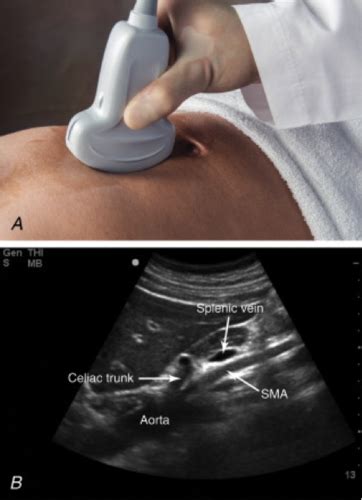 Transducer Position And Image Orientation Flashcards Quizlet