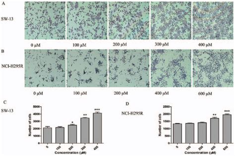 Tudca Promotes The Invasiveness Of Sw And Nci H R Cells After