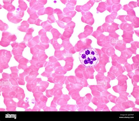 Neutrophil Hypersegmentation Light Micrograph Stock Photo Alamy