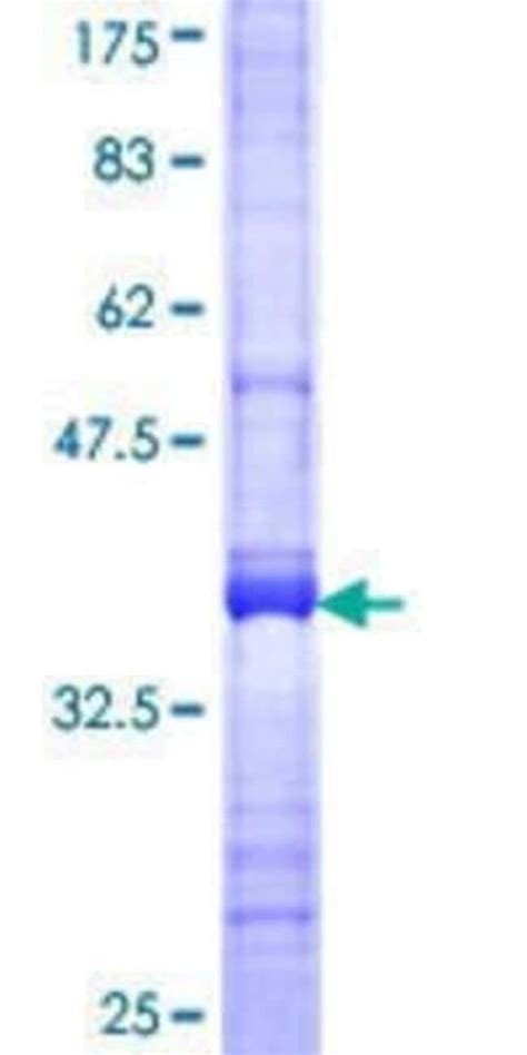 Novus Biologicals Recombinant Human DAPP1 GST N Term Protein 25 μg