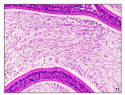 Photomicrograph Of The Cross Section Of Cauda Epididymis Of Control Rat