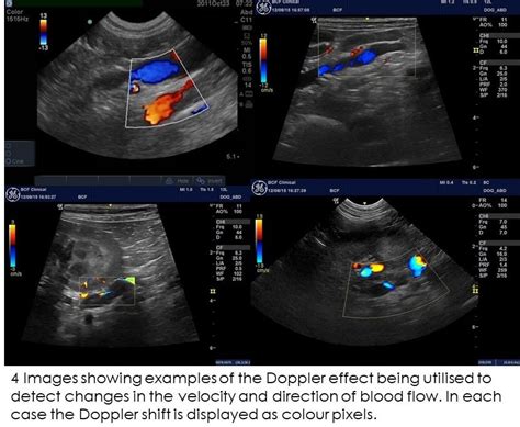 Ultrasound Doppler Explained For Vets Imv Imaging Hot Sex Picture