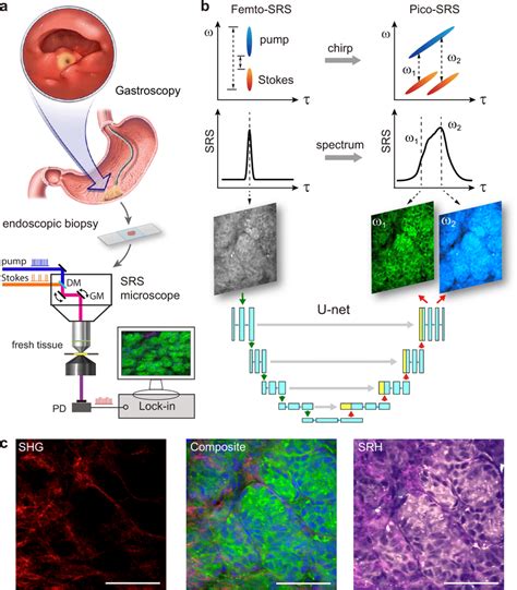 Experimental Design And Workflow A Illustration Of Gastroscopy And Download Scientific Diagram