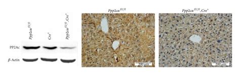 PP2Acα knockout alleviated liver injury induced by chronic CCl4