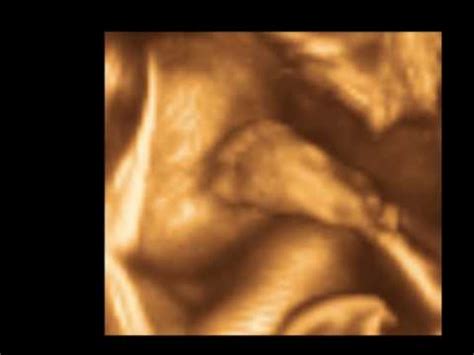 33Weeks Baby 3D 4D Ultrasound Scan Charlotte 4D Ultrasound YouTube