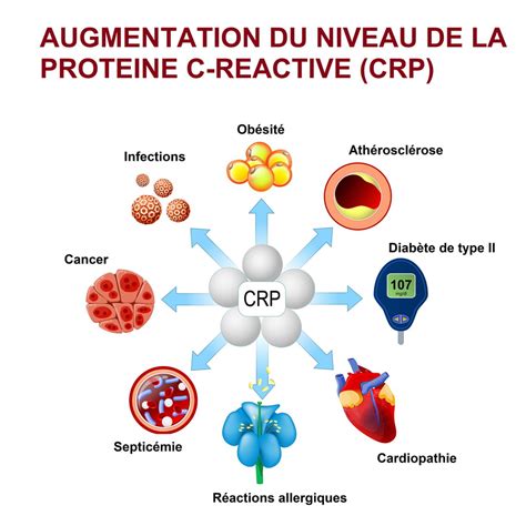 Protéine C-réactive (CRP) : norme, taux élevé, inquiétant