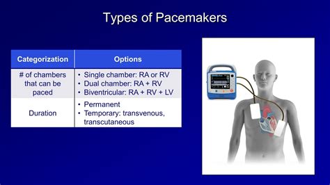 Pacemaker Types - Pacemaker Terminology Questions And Answers In Mri ...