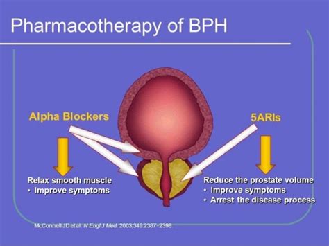 Alpha blockers