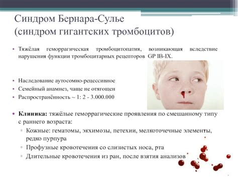 Отличия экхимоза от гематомы - фото презентация