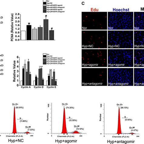 PiR63076 Mediated Hypoxiainduced PASMC Proliferation But Not