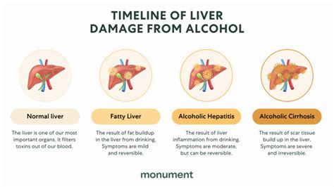 How Many Years of Drinking Alcohol Causes Liver Damage? | Monument