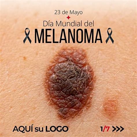 23 • Mayo • DÍa Mundial Del Melanoma Farmacanva