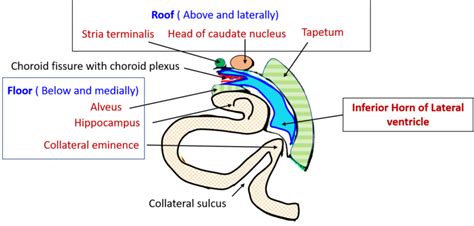 Lateral Ventricle – Anatomy QA