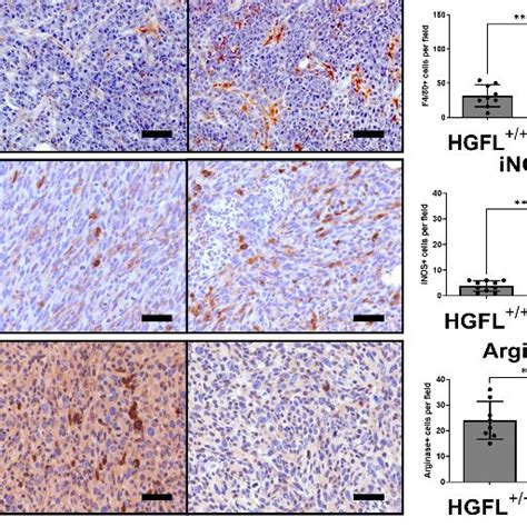 RON And HGFL Overexpression Co Occur In The Murine MMTV PyMT Model Of