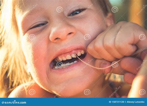 The Process Of Removing A Baby Tooth Using A Thread Stock Photo Image