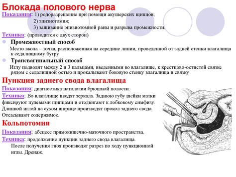 Топография таза и операции на органах таза - презентация онлайн