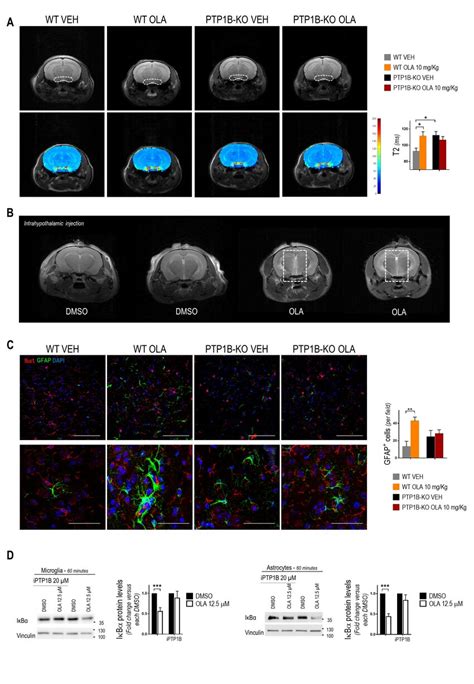 Effects Of OLA I P Administration In Astrocyte And Microglia