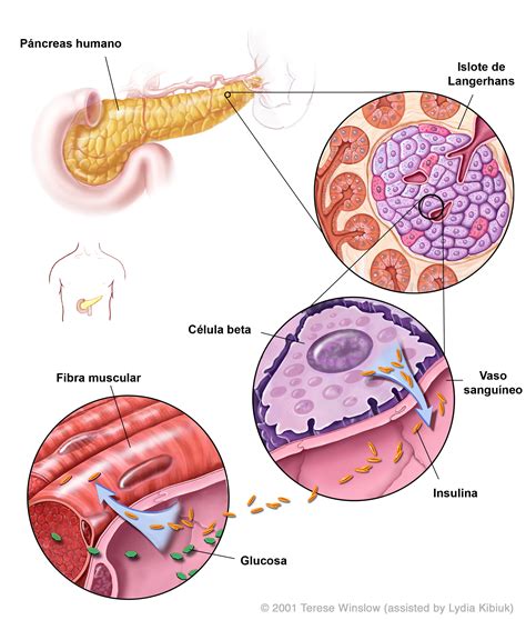 Diabetes Cómo pueden ayudar las células madre Eurostemcell