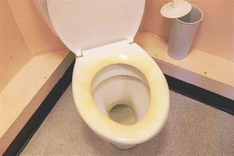 What Causes Yellow Stains On Toilet Seat Updated August 2022