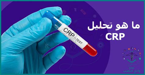 ما هو تحليل Crp وما هي النسب الطبيعية له