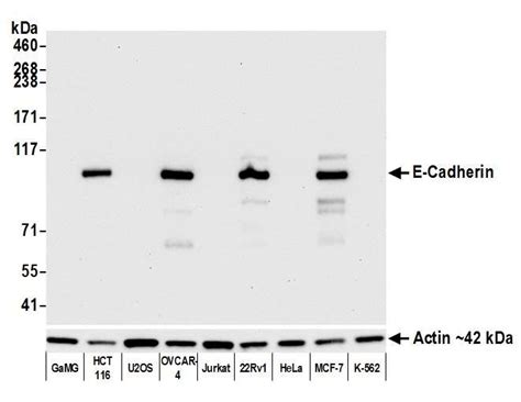 Anti E Cadherin Recombinant Monoclonal Bethyl Laboratories Biomol