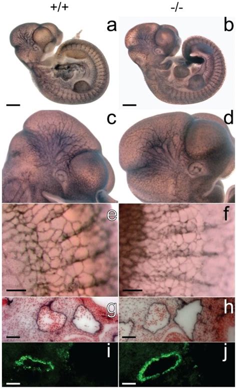 Patterning Of Blood Vessels Is Normal In GPR126LacZ Embryos Wild Type