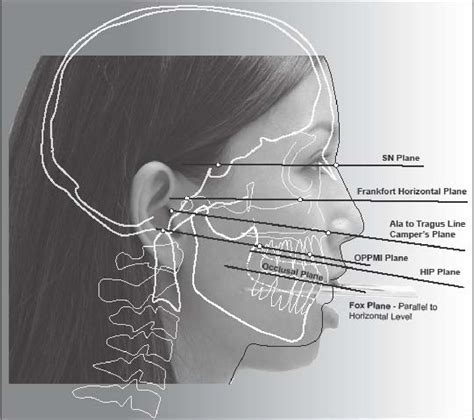 Figure 17 From A Review Of The Clinical Significance Of The Occlusal