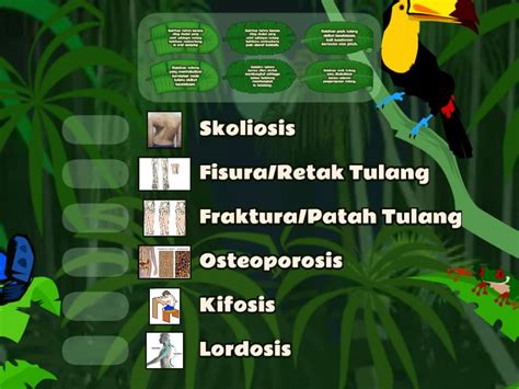 kelainan  tulang match