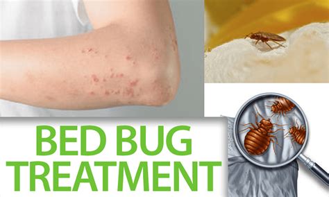 Bedbugs Treatment