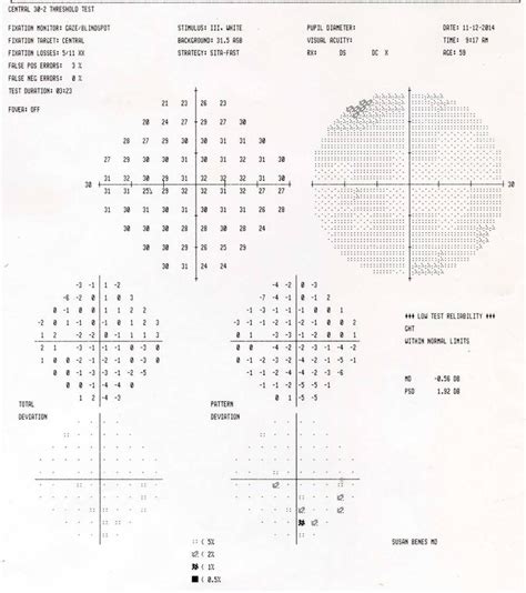 Humphrey Visual Field Of The Left Eye On November Year