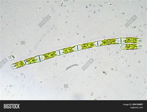 Algae Under Microscope Image & Photo (Free Trial) | Bigstock