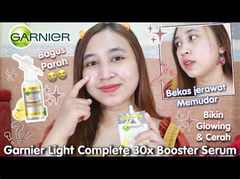 Garnier Untuk Menghilangkan Bekas Jerawat Dan Flek Hitam Leonard Slater