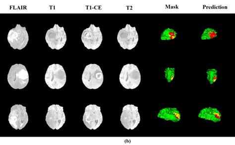 Display Of Segmentation Results In The Training Set Download Scientific Diagram