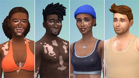 'The Sims 4' adds vitiligo in free update | Mashable