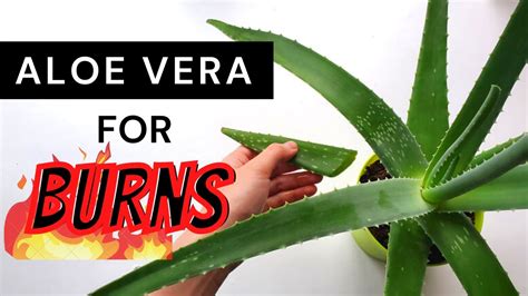 How To Use Fresh Aloe Vera Plant For Burns Youtube