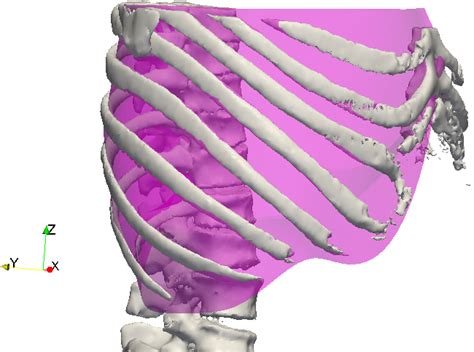 The B-Spline surface fitted through the rib cage models the fascia: (a ...