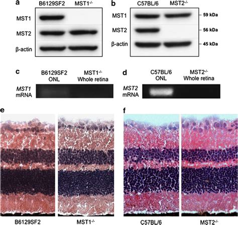 Mst And Mst Expressions In The Retina A And B Western Blot