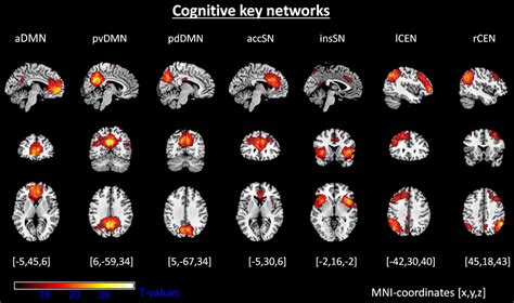 Frontiers Mindfulness Is Associated With Intrinsic Functional