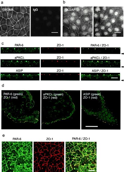 Colocalization Of Par 6 Apkcλ And Asippar 3 With Zo 1 At The Apical Download Scientific