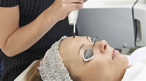 Q Switched Nd Yag Laser Nepal Skin And Aesthetic Centre Best Skin