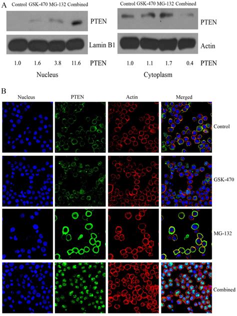 Pdk1 Inhibitor Gsk2334470 Synergizes With Proteasome Inhibitor Mg‑132 In Multiple Myeloma Cells