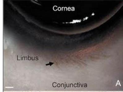 Conjunctiva Flashcards Quizlet