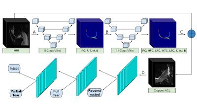 Radiology Artificial Intelligence On Twitter Throwbackthursday A