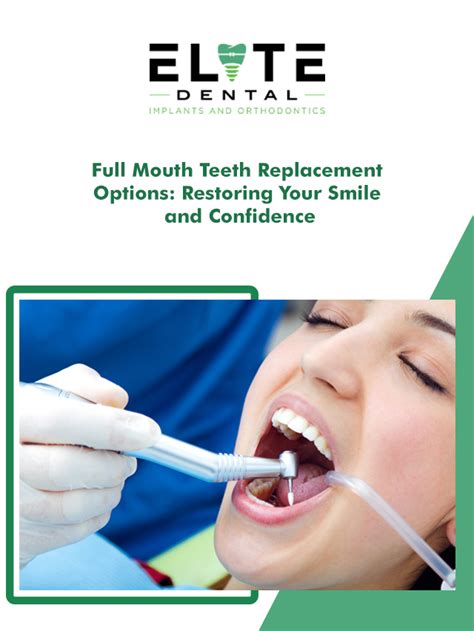 Full Mouth Teeth Replacement Options Restoring Your Smile And